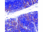 TNFRSF14 Antibody in Immunohistochemistry (Paraffin) (IHC (P))
