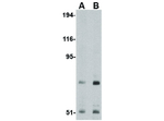 TNPO3 Polyclonal Antibody