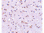 TOCA-1 Antibody in Immunohistochemistry (Paraffin) (IHC (P))