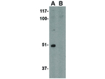 TOCA-1 Antibody in Western Blot (WB)