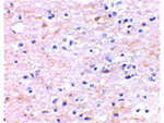 TOCA-1 Antibody in Immunohistochemistry (Paraffin) (IHC (P))