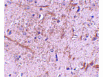TOM70 Antibody in Immunohistochemistry (Paraffin) (IHC (P))