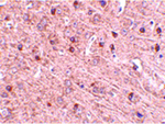 TOM70 Antibody in Immunohistochemistry (Paraffin) (IHC (P))
