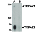 TOPAZ1 Antibody in Western Blot (WB)
