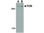mTOR Antibody in Western Blot (WB)