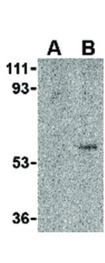 TOSO Polyclonal Antibody