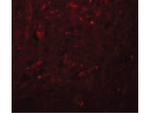 TRESK Polyclonal Antibody