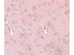 TRESK Antibody in Immunohistochemistry (Paraffin) (IHC (P))