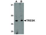 TRESK Antibody in Western Blot (WB)