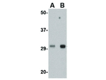 TREX1 Antibody in Western Blot (WB)