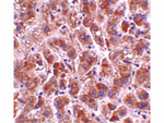 TREX2 Antibody in Immunohistochemistry (Paraffin) (IHC (P))