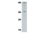 TREX2 Antibody in Western Blot (WB)