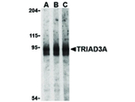 TRIAD3A Antibody in Western Blot (WB)