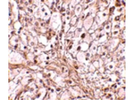 TRIM30 Antibody in Immunohistochemistry (Paraffin) (IHC (P))