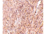 TRIM30 Antibody in Immunohistochemistry (Paraffin) (IHC (P))