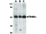 TRIM5 alpha Antibody in Western Blot (WB)