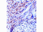 TRIM5 alpha Polyclonal Antibody
