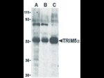 TRIM5 alpha Antibody in Western Blot (WB)