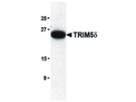 TRIM5 delta Antibody in Western Blot (WB)