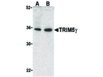 TRIM5 gamma Antibody in Western Blot (WB)