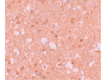 TRIM71 Antibody in Immunohistochemistry (Paraffin) (IHC (P))