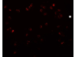 TRIP6 Antibody in Immunocytochemistry (ICC/IF)