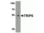 TRIP6 Antibody in Western Blot (WB)