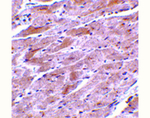 TRPC3 Polyclonal Antibody