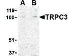 TRPC3 Antibody in Western Blot (WB)