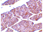 TRPC3 Antibody in Immunohistochemistry (Paraffin) (IHC (P))