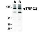 TRPC3 Antibody in Western Blot (WB)