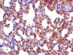 TRPC6 Antibody in Immunohistochemistry (Paraffin) (IHC (P))