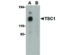 TSC1 Antibody in Western Blot (WB)