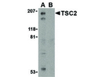 TSC2 Polyclonal Antibody