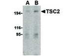 TSC2 Antibody in Western Blot (WB)