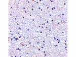 TSLP Antibody in Immunohistochemistry (Paraffin) (IHC (P))