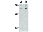 TSLP Antibody in Western Blot (WB)