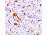 Tslp Antibody in Immunohistochemistry (Paraffin) (IHC (P))