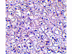 TSLP Receptor Antibody in Immunohistochemistry (Paraffin) (IHC (P))