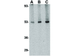 TSLP Receptor Antibody in Western Blot (WB)