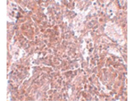 TSPAN9 Antibody in Immunohistochemistry (Paraffin) (IHC (P))