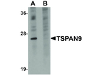 TSPAN9 Antibody in Western Blot (WB)