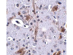 TTBK1 Antibody in Immunohistochemistry (Paraffin) (IHC (P))
