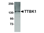 TTBK1 Antibody in Western Blot (WB)