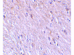 TTC5 Antibody in Immunohistochemistry (Paraffin) (IHC (P))