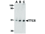 TTC5 Antibody in Western Blot (WB)