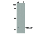 TXNIP Polyclonal Antibody