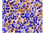 UBC13 Antibody in Immunohistochemistry (Paraffin) (IHC (P))