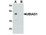 UBIAD1 Antibody in Western Blot (WB)