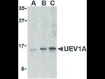 UEV1A Polyclonal Antibody